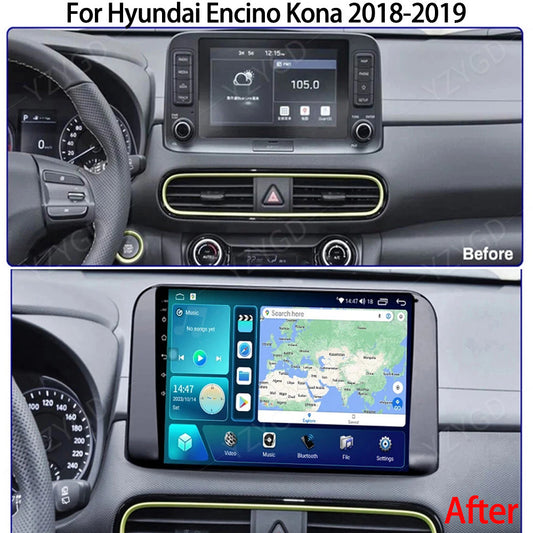for Hyundai Encino Kona 2018-2019 Multimedia CarPlay Car Stereo Radio GPS Screen